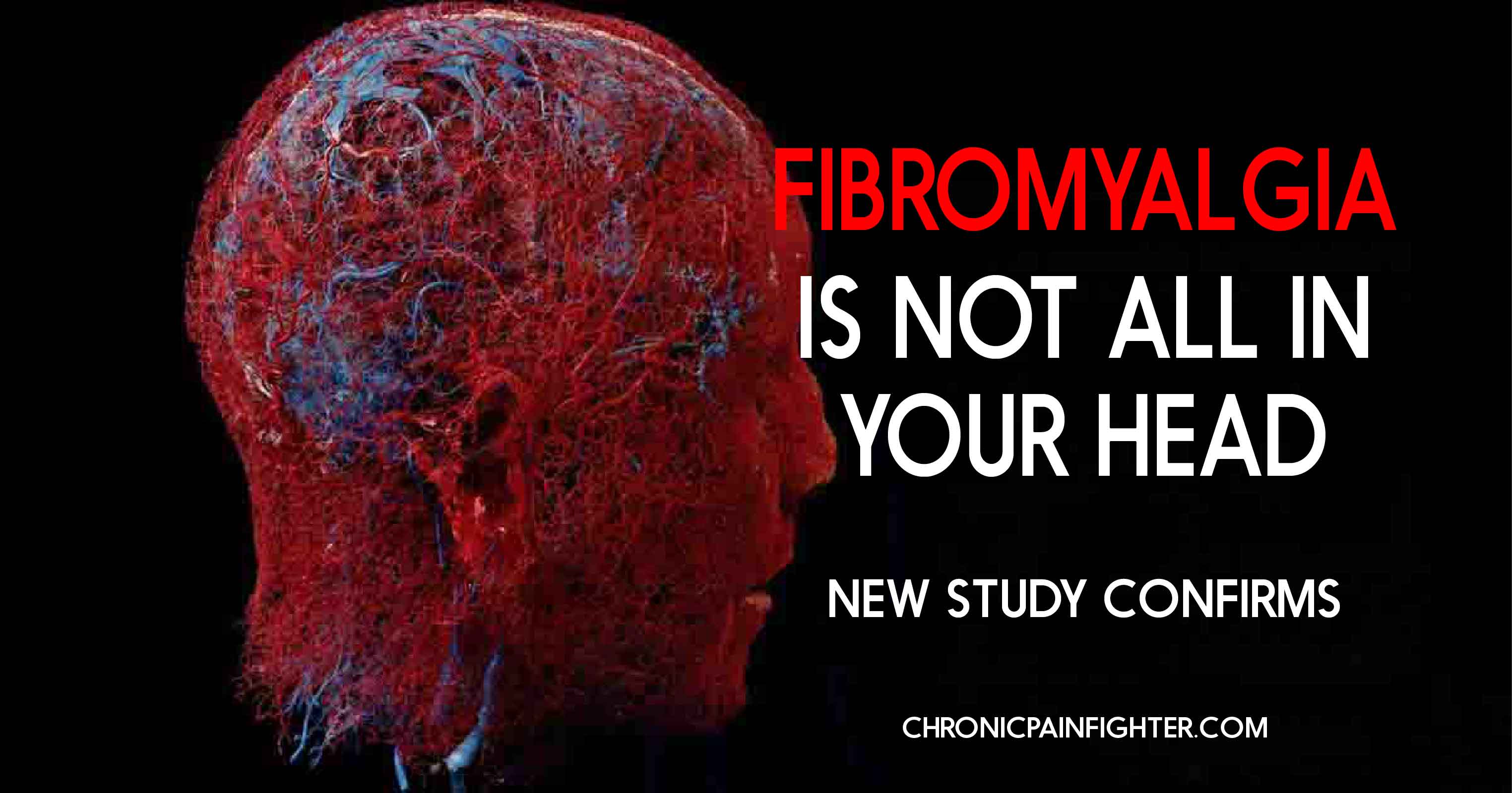 Fibromyalgia is Not All In Your Head, New Study Confirms