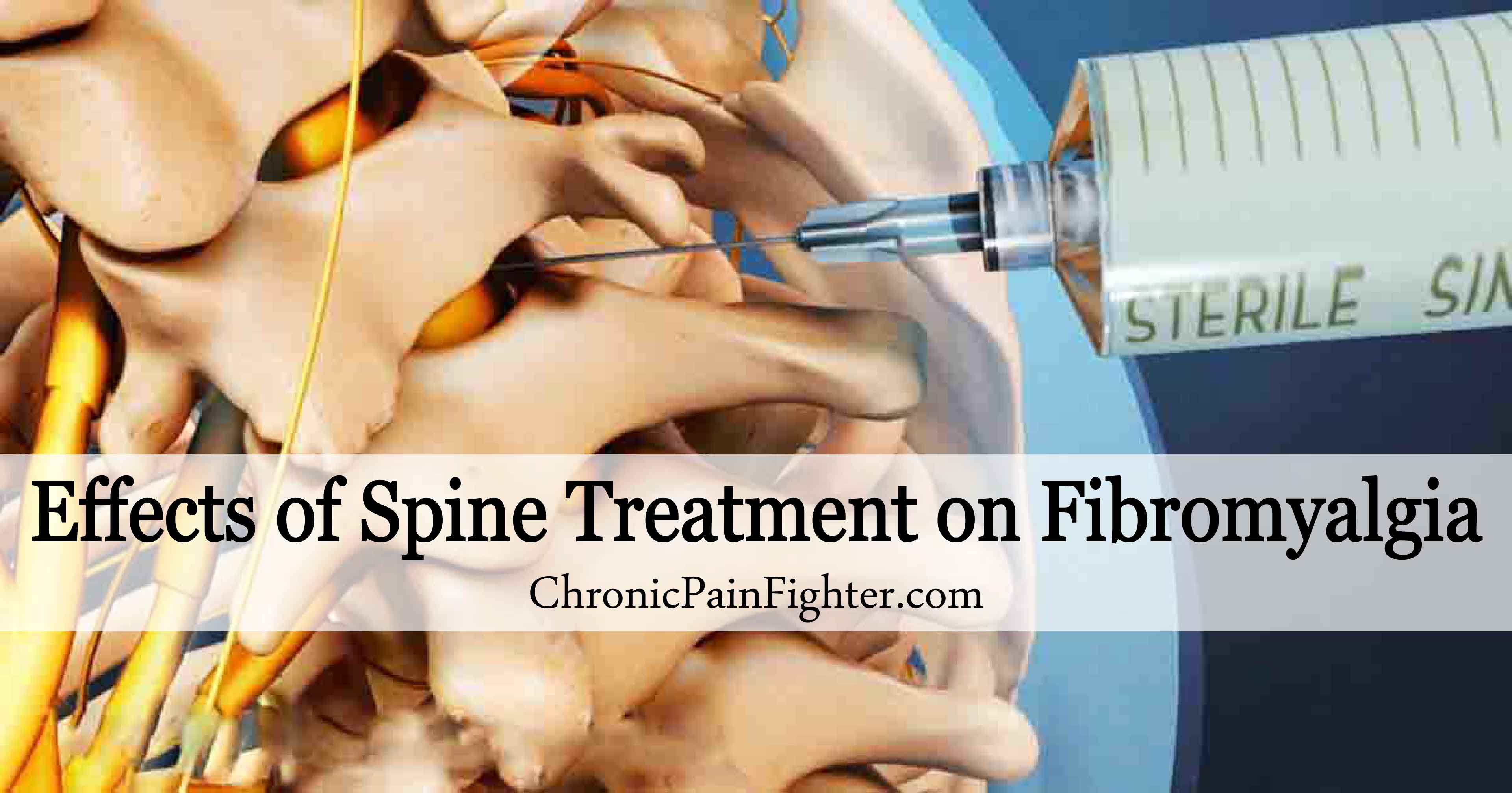 Effects of Spine Treatment on Fibromyalgia