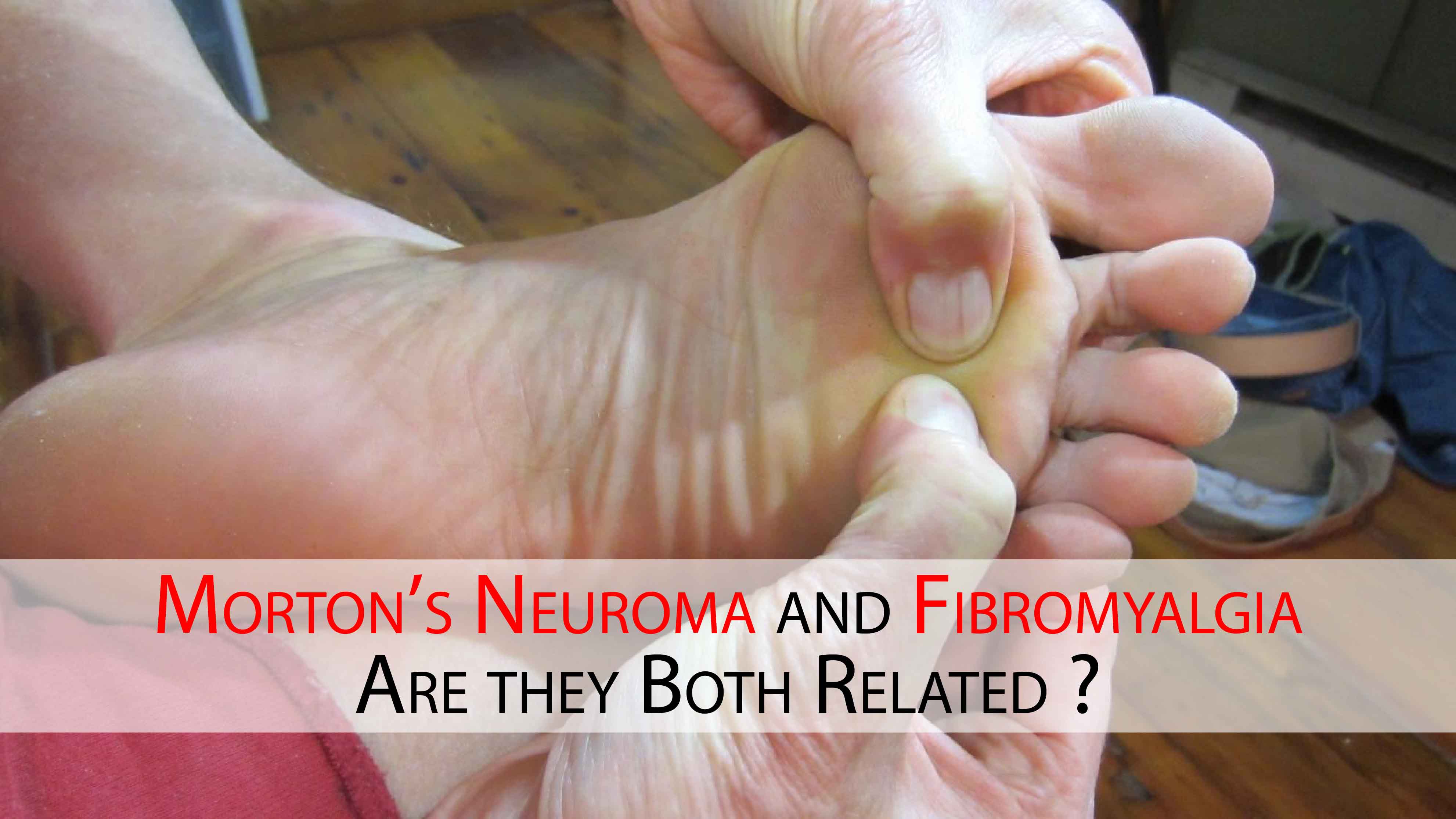 Morton’s Neuroma and Fibromyalgia. Are they Both Related ?