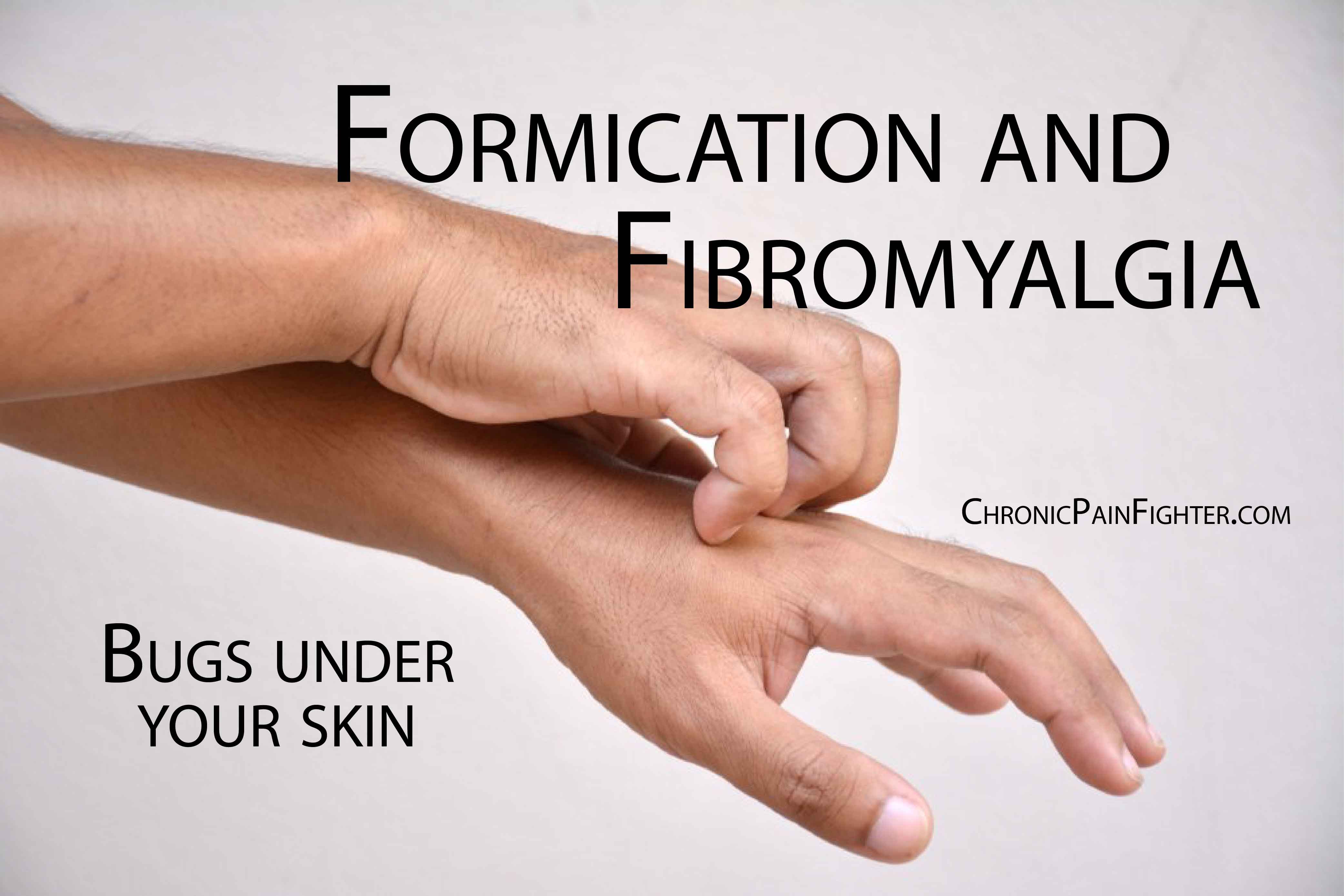 Formication and Fibromyalgia