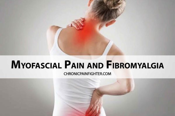 Myofascial Pain and Fibromyalgia