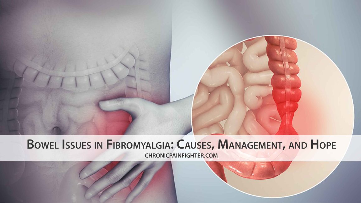 Bowel Issues in Fibromyalgia: Causes, Management, and Hope