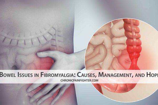 Bowel Issues in Fibromyalgia: Causes, Management, and Hope