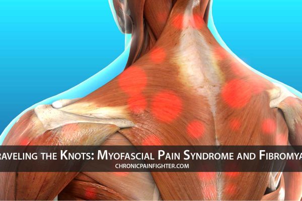 Unraveling the Knots: Myofascial Pain Syndrome and Fibromyalgia